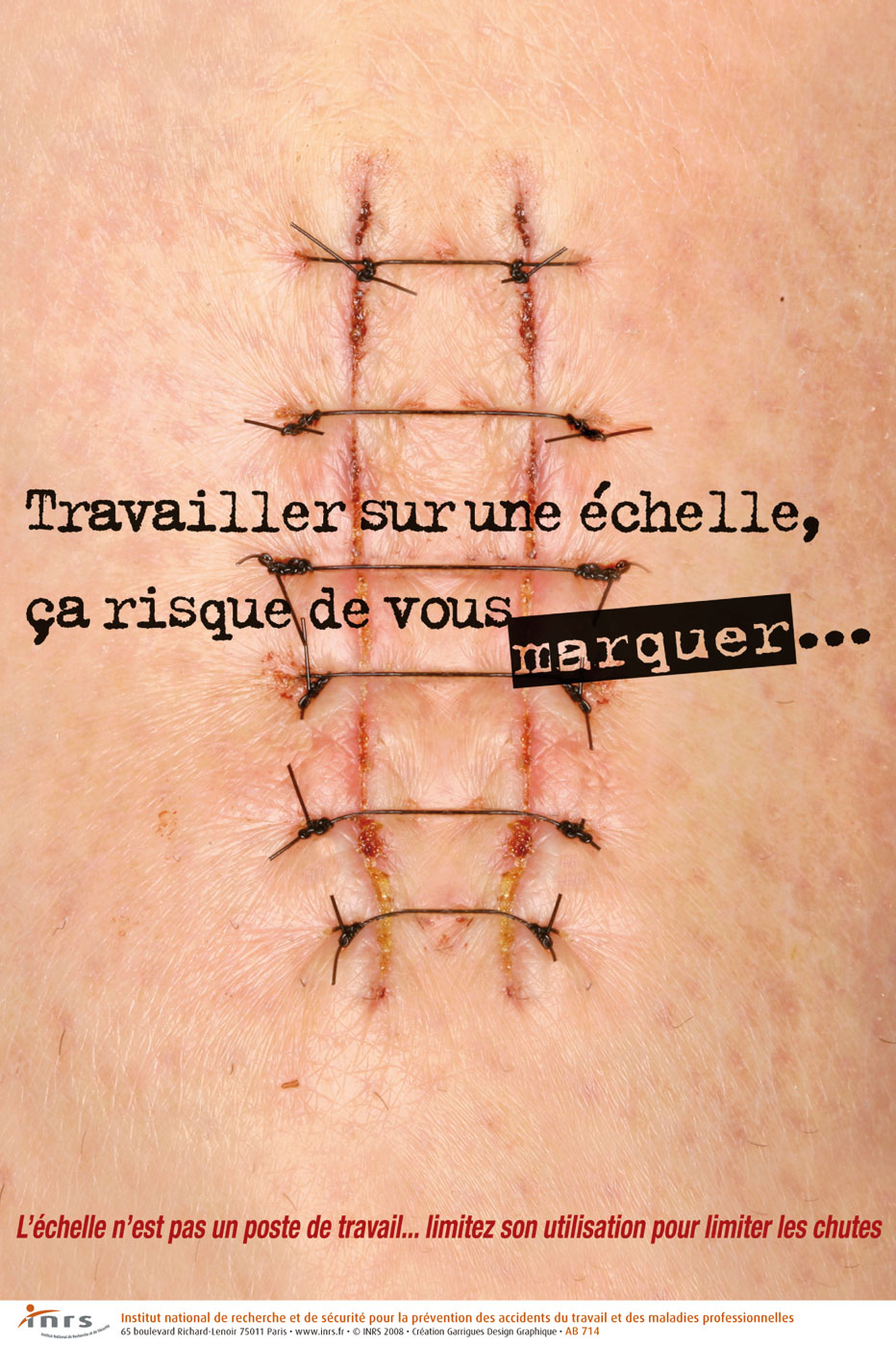 DBM 620 trepied danger accident INRS